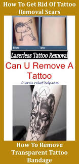 Ink color of the tattoo; Most Effective Tattoo Removal How Much Does Excision Tattoo Removal Cost Tattoo Removal Cream Buy Onlin Tattoo Removal Cost Tattoo Removal Tattoo Removal Cream