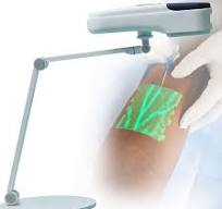 Amazon.com: Infrared Vein Finder Medical Infrared Vein ...
