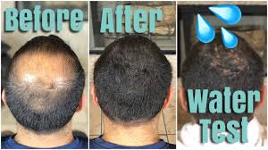That includes allergic skins too. Hair Fiber Tips Is Hair Fiber Waterproof Youtube