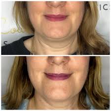 ✨ Transform Your Body & Well-Being with Cutting-Edge Technology! 25% OFF  for the first 10 clients that book an EXION Body Course by the end of the  month! ✨ Looking for non-surgical