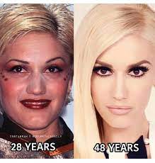 We did not find results for: Gwen Stefani Botchedsurgeries