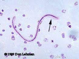 Diagnostic Parasitology Microfilariae Hematology Microbiology Science