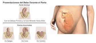 Como Esta Colocado Mi Bebe Babybe Fisioterapia