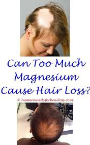 Pin On Hair Loss Stoppers