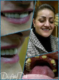 الدكتور عطاف ديب