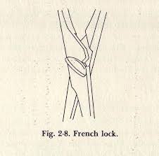 Its principal use is to embrace the fetal head and make sure to pull it out of the vaginal canal. Obstetric Forceps Then And Now