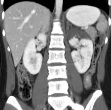 Image result for Genitourinary Trauma