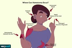 Your ribs protect soft, fragile organs like your heart and lungs. 2gq7dj9exzscgm