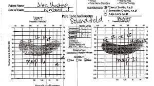 beeps for speech and reverberation my hearing journey