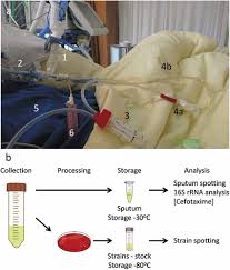 Image result for Sputum