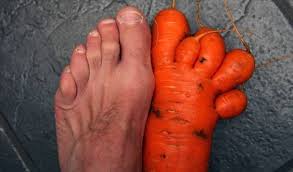 Outbreak Of Debilitating Carrot Foot In The Central West Www Highwaywest Com If You Like This Post Please Like Funny Vegetables Vegan Memes Funny Fruit