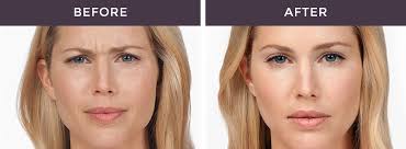 But check out her latest picture, which hints that her botox is withering. Botox Terrell Clinic Liposuction And Anti Aging In Oklahoma City