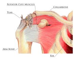 Image result for Rotator Cuff Injury