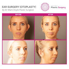 Regardless of the method, it should be done in a sterile environment. Ear Surgery Otoplasty Gold Coast Brisbane Dr Doyle Plastic Surgeon