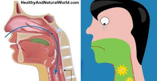 Coughing Up Green Or Yellow Mucus What It Means Including Thick Mucus Yellow Mucus Coughing Up Mucus Mucus Cough