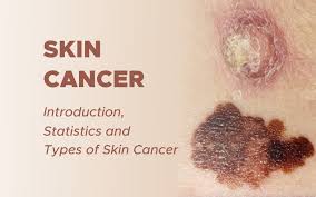 Some types of skin cancer are more dangerous than others, but if you have a spot. Skin Cancer Introduction Statistics And Types Of Skin Cancer Surgmedia