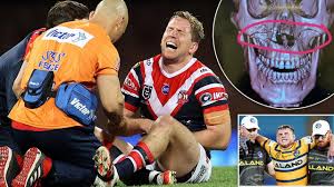 See full list on iii.org Nrl Injury Crisis Carnage Of The 2020 Rugby League Season Revealed