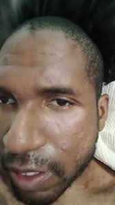 Jermaine: A queer Black multi-disabled activist facing eviction with $4,690  in back rent due. Community support is crucial for their stability. Donate  to: • VENMO: , @jermaine, -greaves • PAYPAL: ...