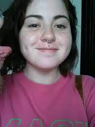 Day 5 They Are Still Swelling But You Can See The Piercings Are Forming Dimples Already Cheek Piercings Piercings Nose Ring