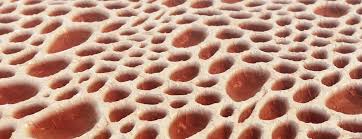 Image result for Bone Marrow Exam