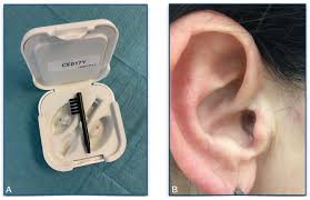 Top 10 Best Ear Wax Removal In Oakville, On - Updated 2024 - Yelp