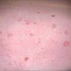(pathology) any of a number of autoimmune diseases, the most common of which is systemic lupus erythematosus. Https Encrypted Tbn0 Gstatic Com Images Q Tbn And9gctmrb7usdeyxar2fwivni Olocyvrr114l7qivb Apkw8ddrwb Usqp Cau