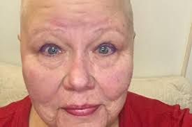 Fundraiser for Kathleen Hopkins by Daniel Vislocky : Kat's Courage  (Danielle Kathleen Hopkins)