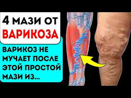 как избавиться от целлюлита при варикозе в домашних условиях Pin Na Doske Zdorove