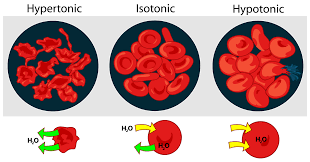 Students who were then studying in uk. How Do Red Blood Cells React In Distilled Water Quora