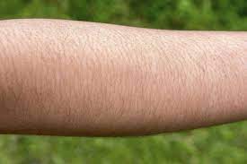 I like my arm hair, but i wanted it to go lighter and match my skin tone, so i went and bought this body hair bleach, and. How To Get Rid Of Arm Hair Getridofthings Com