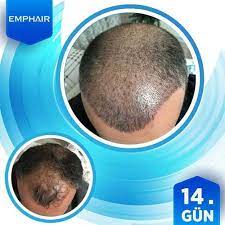 Pin On Igne Isi