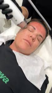 📍 We recently provided comprehensive training at Skintique, Perth,