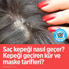 Sac Kepegi Nasil Gecer Kepegi Geciren Kur Ve Maske Tarifleri Faydali Bilgin Sac Bilgi Maskeler
