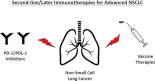 Weight loss is also almost universal, and it occurs even when people are eating a diet with adequate calories. Immunotherapy As A Second Line Or Later Treatment Modality For Advanced Non Small Cell Lung Cancer A Review Of Safety And Efficacy Sciencedirect