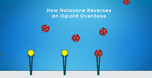 Image result for Opioid Overdose