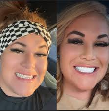 Showing off new smile after dental work