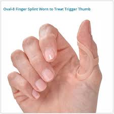 Below are 44 working coupons for mallet finger splint cpt code from reliable websites that we have updated for users to get maximum savings. Oval 8 Graduated Set