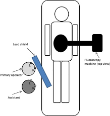 Function #coordinates was not found. Eye Lens Dose Of Medical Personnel Involved In Fluoroscopy And Interventional Procedures At A Malaysian Hospital Physica Medica European Journal Of Medical Physics
