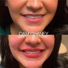 Pam Chaney Aesthetics and Wellness (@pamchaneyaesthetics) · Elkhart, IN