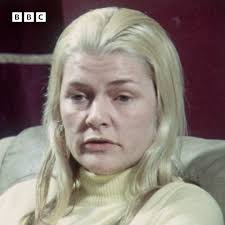 Plastic #surgery gone wrong