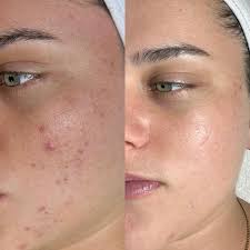 Hi everyone! I'm Elvira Cane, a Permanent Makeup Artist & Licensed  Esthetician with 4 years of experience, specializing in: & Lip Blush