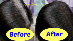 It is found that a buildup of hydrogen peroxide in the hair follicles and in the scalp can result in hair thinning and premature gray hair. How To Get Rid Of Grey Hair Works Natural Home Remedies Lovely Beauty Tips Youtube