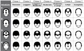 Stempiatura fisiologica a 20 anni. Capelli Uomo Quali Sono Le Cause Della Perdita 1channel