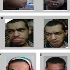 Cécile Mignon-Ravix's research works