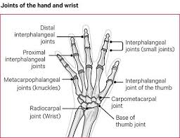 Hand And Wrist Pain Causes Exercises Treatments