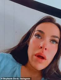 Emotional Stephanie Davis opens up about the 'terrifying' moment her baby  son Samuel, three months, stopped breathing for the second time