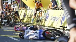 Jakobsen broke all the bones in his face fabio jakobsen broke all the bones in his face. The Tragic Consequences Of A Horror Fall 130 Stitches In The Face Only One Tooth In The Mouth