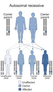 Picture of Citrullinemia type I