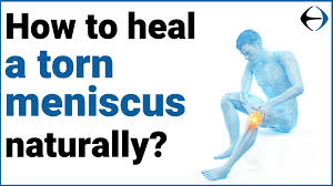 Unfortunately, knee injuries are popular. How To Heal A Torn Meniscus Naturally Evercore Move With A Strong Healthy Body