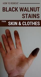 How To Remove Black Walnut Stains From Skin And Clothes 101cleaningtips Net Walnut Stain Cleaning Hacks House Cleaning Tips